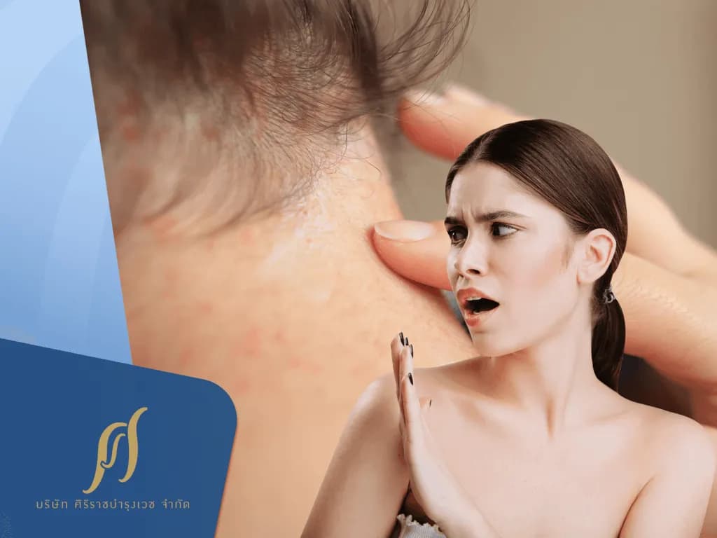 7 ส่วนผสมในแชมพูที่ควรเช็กให้ชัวร์ก่อนซื้อ !